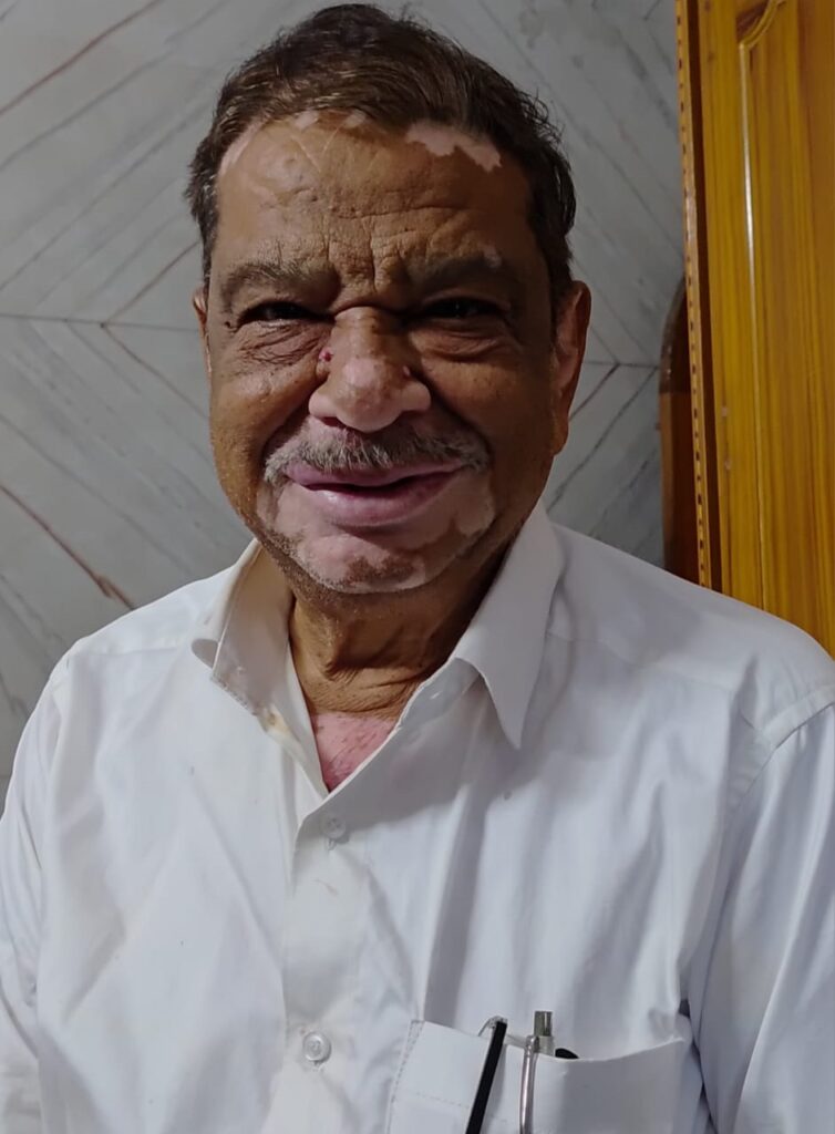 గోతుల మయంగా మారిన పేట రోడ్లుప్రమాదాలకు కారణమౌతున్న గోతులు