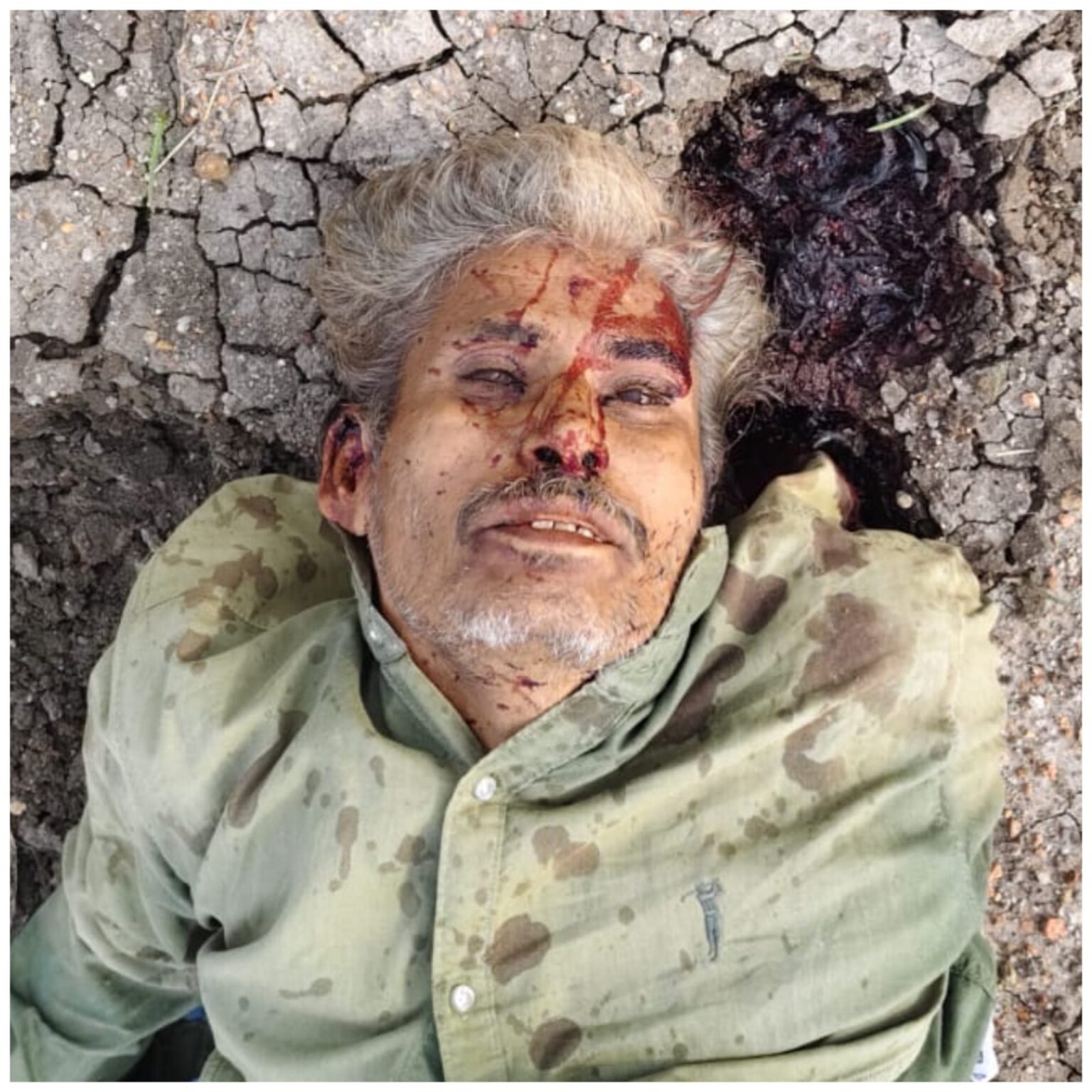 చిలకలూరిపేట-ఓడరేవు జాతీయ రహదారిపై పసుమర్రు వద్ద రోడ్డు ప్రమాదం